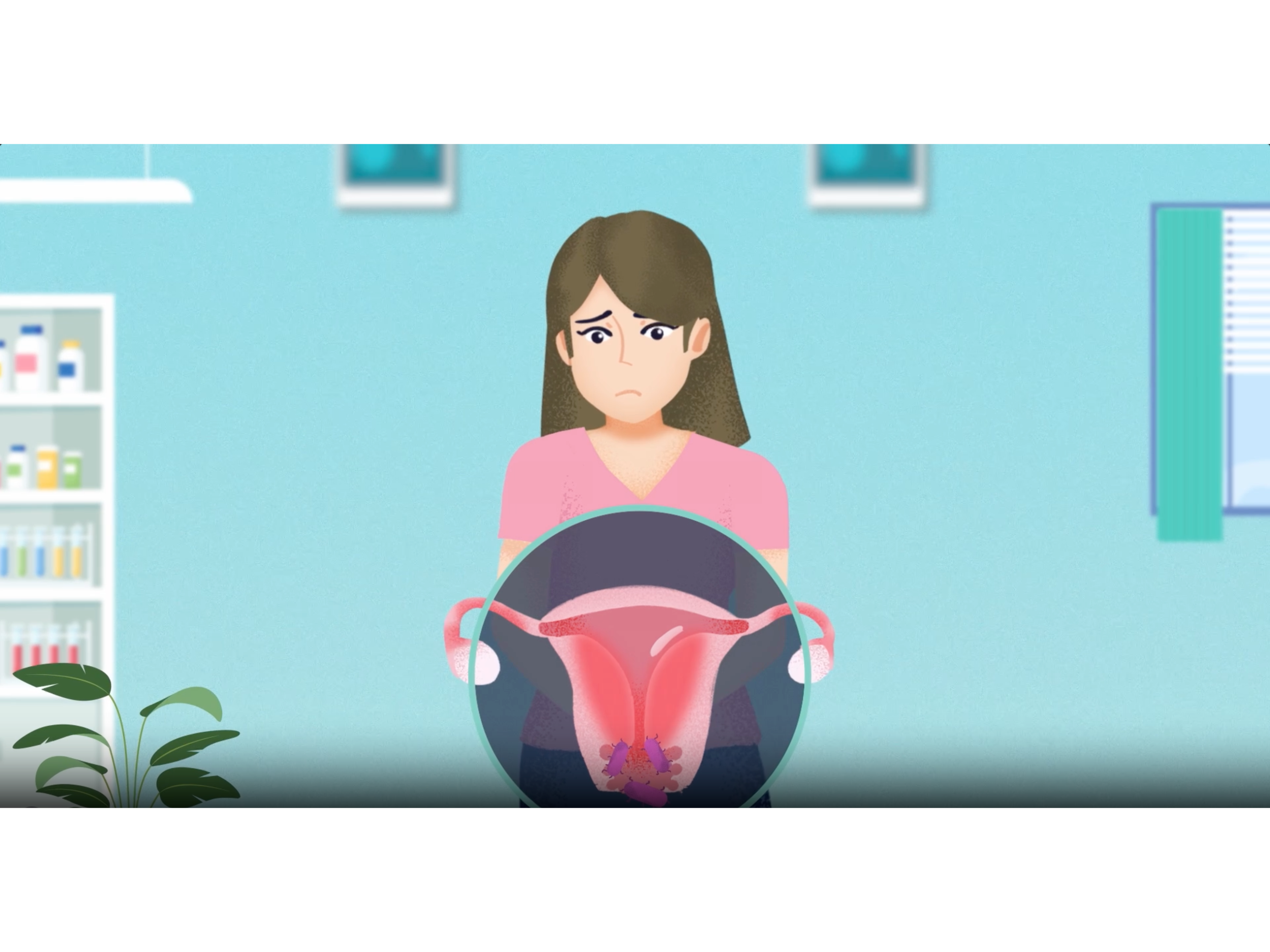 animated woman with gardnerella symptoms